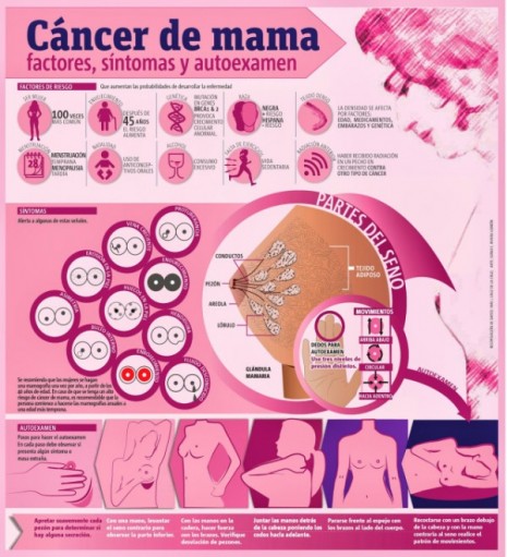 infografia-cancer-de-mama1