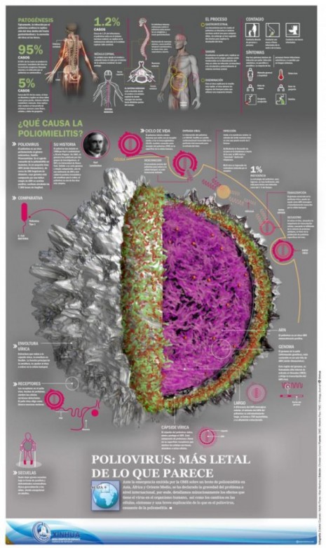 infografia_poliomielitis